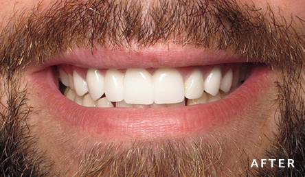 Dentistry After | Evers and Gardner Dental | KC North Dentist